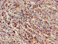 USP6NL Antibody - Immunohistochemistry of paraffin-embedded human adrenal gland tissue at dilution of 1:100