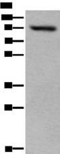 USP6NL Antibody - Western blot analysis of 293T cell lysate  using USP6NL Polyclonal Antibody at dilution of 1:400