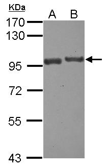 USP6NL Antibody - Sample (30 ug of whole cell lysate) A: A431 B: Jurkat 7.5% SDS PAGE USP6NL antibody diluted at 1:1000