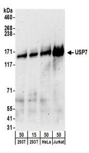 USP7 / HAUSP Antibody - Detection of Human USP7 by Western Blot. Samples: Whole cell lysate from 293T (15 and 50 ug), HeLa (50 ug), and Jurkat (50 ug) cells. Antibodies: Affinity purified goat anti-USP7 antibody used for WB at 0.1 ug/ml. Detection: Chemiluminescence with an exposure time of 3 minutes.