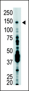 USP7 / HAUSP Antibody - The anti-USP7 antibody is used in Western blot to detect USP7 in T-47D cell lysate.