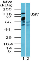 USP7 / HAUSP Antibody - Western blot of USP7 in MCF7 cell lysate in the 1) absence and 2) presence of immunizing peptide using Polyclonal Antibody to USP7 at 1.0 ug/ml. Goat anti-rabbit Ig HRP secondary antibody, and PicoTect ECL substrate solution, were used for this test.
