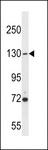 USP7 / HAUSP Antibody - USP7 Antibody western blot of A2058 cell line lysates (35 ug/lane). The USP7 antibody detected the USP7 protein (arrow).