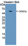 USP7 / HAUSP Antibody - Western blot of USP7 / HAUSP antibody.