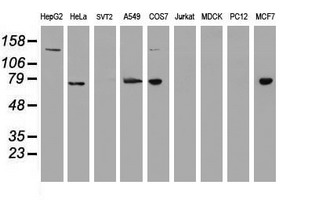 USP7 / HAUSP Antibody - Western blot of extracts (35ug) from 9 different cell lines by using anti-USP7 monoclonal antibody.
