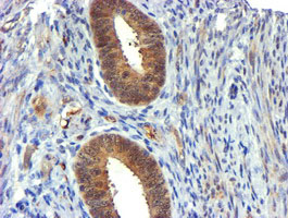 USP7 / HAUSP Antibody - IHC of paraffin-embedded Human endometrium tissue using anti-USP7 mouse monoclonal antibody. (Heat-induced epitope retrieval by 10mM citric buffer, pH6.0, 100C for 10min).