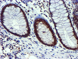 USP7 / HAUSP Antibody - IHC of paraffin-embedded Human colon tissue using anti-USP7 mouse monoclonal antibody.