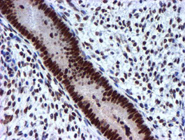 USP7 / HAUSP Antibody - IHC of paraffin-embedded Human endometrium tissue using anti-USP7 mouse monoclonal antibody.