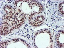 USP7 / HAUSP Antibody - IHC of paraffin-embedded Human breast tissue using anti-USP7 mouse monoclonal antibody.