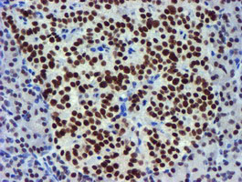 USP7 / HAUSP Antibody - IHC of paraffin-embedded Human pancreas tissue using anti-USP7 mouse monoclonal antibody.