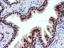 USP7 / HAUSP Antibody - IHC of paraffin-embedded Human prostate tissue using anti-USP7 mouse monoclonal antibody.