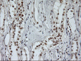 USP7 / HAUSP Antibody - IHC of paraffin-embedded Human Kidney tissue using anti-USP7 mouse monoclonal antibody.