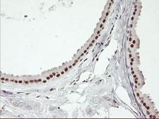 USP7 / HAUSP Antibody - IHC of paraffin-embedded Human breast tissue using anti-USP7 mouse monoclonal antibody.