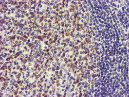 USP7 / HAUSP Antibody - IHC of paraffin-embedded Human lymph node tissue using anti-USP7 mouse monoclonal antibody.
