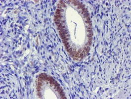 USP7 / HAUSP Antibody - IHC of paraffin-embedded Human endometrium tissue using anti-USP7 mouse monoclonal antibody.