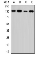 USP7 / HAUSP Antibody - Western blot analysis of USP7 expression in MCF7 (A); Jurkat (B); mouse spleen (C); mouse testis (D) whole cell lysates.