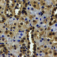 USP7 / HAUSP Antibody - Immunohistochemical analysis of USP7 staining in human kidney formalin fixed paraffin embedded tissue section. The section was pre-treated using heat mediated antigen retrieval with sodium citrate buffer (pH 6.0). The section was then incubated with the antibody at room temperature and detected using an HRP conjugated compact polymer system. DAB was used as the chromogen. The section was then counterstained with hematoxylin and mounted with DPX.