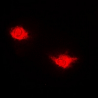 USP7 / HAUSP Antibody - Immunofluorescent analysis of USP7 staining in HeLa cells. Formalin-fixed cells were permeabilized with 0.1% Triton X-100 in TBS for 5-10 minutes and blocked with 3% BSA-PBS for 30 minutes at room temperature. Cells were probed with the primary antibody in 3% BSA-PBS and incubated overnight at 4 deg C in a humidified chamber. Cells were washed with PBST and incubated with a DyLight 594-conjugated secondary antibody (red) in PBS at room temperature in the dark.