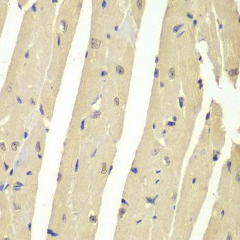 USP7 / HAUSP Antibody - Immunohistochemistry of paraffin-embedded mouse heart using USP7 antibody at dilution of 1:200 (40x lens).