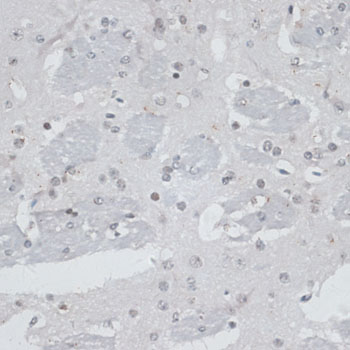 USP7 / HAUSP Antibody - Immunohistochemistry of paraffin-embedded mouse brain using USP7 antibody at dilution of 1:100 (40x lens).