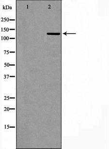 USP7 / HAUSP Antibody - Western blot analysis of HepG2 cells using USP7 antibody. The lane on the left is treated with the antigen-specific peptide.