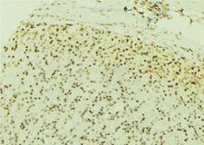USP7 / HAUSP Antibody - 1:100 staining human gastric tissue by IHC-P. The sample was formaldehyde fixed and a heat mediated antigen retrieval step in citrate buffer was performed. The sample was then blocked and incubated with the antibody for 1.5 hours at 22°C. An HRP conjugated goat anti-rabbit antibody was used as the secondary.