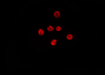 USP7 / HAUSP Antibody - Staining HepG2 cells by IF/ICC. The samples were fixed with PFA and permeabilized in 0.1% Triton X-100, then blocked in 10% serum for 45 min at 25°C. The primary antibody was diluted at 1:200 and incubated with the sample for 1 hour at 37°C. An Alexa Fluor 594 conjugated goat anti-rabbit IgG (H+L) Ab, diluted at 1/600, was used as the secondary antibody.