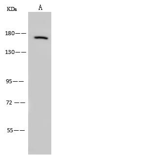 USP7 / HAUSP Antibody - Anti-USP7 rabbit polyclonal antibody at 1:500 dilution. Lane A: NIH-3T3 Whole Cell Lysate. Lysates/proteins at 30 ug per lane. Secondary: Goat Anti-Rabbit IgG (H+L)/HRP at 1/10000 dilution. Developed using the ECL technique. Performed under reducing conditions. Predicted band size: 128 kDa.