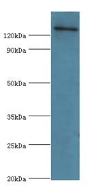 USP8 / UBPY Antibody - Western blot. All lanes: USP8 antibody at 14 ug/ml+293T whole cell lysate. Secondary antibody: Goat polyclonal to rabbit at 1:10000 dilution. Predicted band size: 128 kDa. Observed band size: 128 kDa.