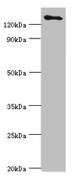 USP8 / UBPY Antibody - Western blot All lanes: USP8 antibody at 14µg/ml + 293T whole cell lysate Secondary Goat polyclonal to rabbit IgG at 1/10000 dilution Predicted band size: 128, 116 kDa Observed band size: 128 kDa