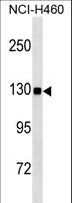 USP8 / UBPY Antibody - USP8 Antibody (C1072) western blot of NCI-H460 cell line lysates (35 ug/lane). The USP8 antibody detected the USP8 protein (arrow).