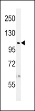 USP8 / UBPY Antibody - USP8-C1072 western blot of WiDr cell line lysates (35 ug/lane). The USP8 antibody detected the USP8 protein (arrow).