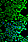 USP8 / UBPY Antibody - Immunofluorescence analysis of A549 cells.