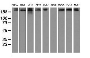 USP9X / FAM Antibody - Western blot of extracts (35ug) from 9 different cell lines by using anti-USP9X monoclonal antibody (HepG2: human; HeLa: human; SVT2: mouse; A549: human; COS7: monkey; Jurkat: human; MDCK: canine; PC12: rat; MCF7: human).