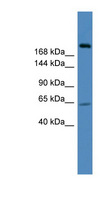 USP9X / FAM Antibody - USP9X antibody Western blot of 293T cell lysate. This image was taken for the unconjugated form of this product. Other forms have not been tested.