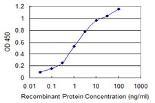 USP9X / FAM Antibody - Detection limit for recombinant GST tagged USP9X is 0.03 ng/ml as a capture antibody.
