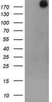 USP9X / FAM Antibody - HEK293T cells were transfected with the pCMV6-ENTRY control (Left lane) or pCMV6-ENTRY USP9X (Right lane) cDNA for 48 hrs and lysed. Equivalent amounts of cell lysates (5 ug per lane) were separated by SDS-PAGE and immunoblotted with anti-USP9X.