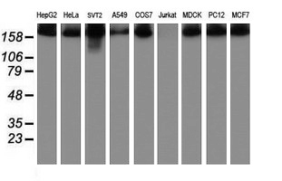 USP9X / FAM Antibody - Western blot of extracts (35 ug) from 9 different cell lines by using g anti-USP9X monoclonal antibody (HepG2: human; HeLa: human; SVT2: mouse; A549: human; COS7: monkey; Jurkat: human; MDCK: canine; PC12: rat; MCF7: human).