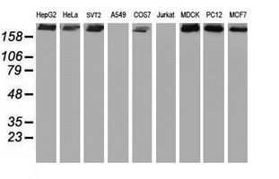 USP9X / FAM Antibody - Western blot of extracts (35 ug) from 9 different cell lines by using g anti-USP9X monoclonal antibody (HepG2: human; HeLa: human; SVT2: mouse; A549: human; COS7: monkey; Jurkat: human; MDCK: canine; PC12: rat; MCF7: human).
