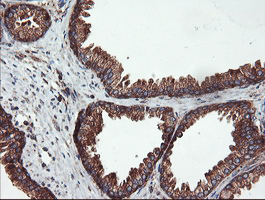 USP9X / FAM Antibody - IHC of paraffin-embedded Human prostate tissue using anti-USP9X mouse monoclonal antibody.