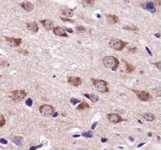 USP9X / FAM Antibody - Immunohistochemistry: USP9x Antibody - IHC of Usp9x in brain tissue.  This image was taken for the unconjugated form of this product. Other forms have not been tested.