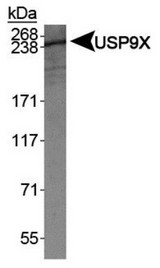 USP9X / FAM Antibody - Western Blot: USP9x Antibody - Analysis of USP9X in Caco-2 whole cell lysates.  This image was taken for the unconjugated form of this product. Other forms have not been tested.