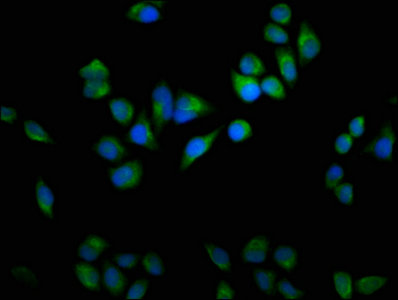 USP9X / FAM Antibody - Immunofluorescence staining of Hela cells with USP9X Antibody at 1:100, counter-stained with DAPI. The cells were fixed in 4% formaldehyde, permeabilized using 0.2% Triton X-100 and blocked in 10% normal Goat Serum. The cells were then incubated with the antibody overnight at 4°C. The secondary antibody was Alexa Fluor 488-congugated AffiniPure Goat Anti-Rabbit IgG(H+L).