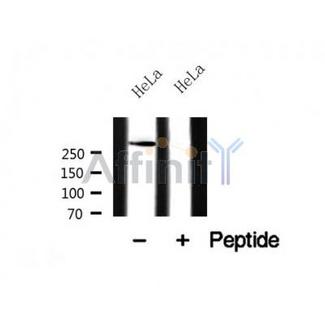 USP9X / FAM Antibody - Western blot analysis of USP9X in lysates of HeLa