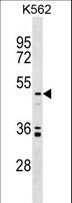 UST Antibody - UST Antibody western blot of K562 cell line lysates (35 ug/lane). The UST antibody detected the UST protein (arrow).
