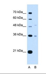 UST Antibody - Lane A: Marker. Lane B: HepG2 cell lysate. Antibody concentration: 2.5 ug/ml. Gel concentration: 12%.  This image was taken for the unconjugated form of this product. Other forms have not been tested.