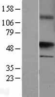 UST Protein - Western validation with an anti-DDK antibody * L: Control HEK293 lysate R: Over-expression lysate