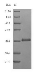 RNU2 Protein - (Tris-Glycine gel) Discontinuous SDS-PAGE (reduced) with 5% enrichment gel and 15% separation gel.