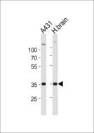 UTF1 Antibody - Western blot of lysates from A431 cell line, human brain tissue lysate (from left to right), using UTF1 antibody diluted at 1:1000 at each lane. A goat anti-rabbit IgG H&L (HRP) at 1:10000 dilution was used as the secondary antibody. Lysates at 20 ug per lane.