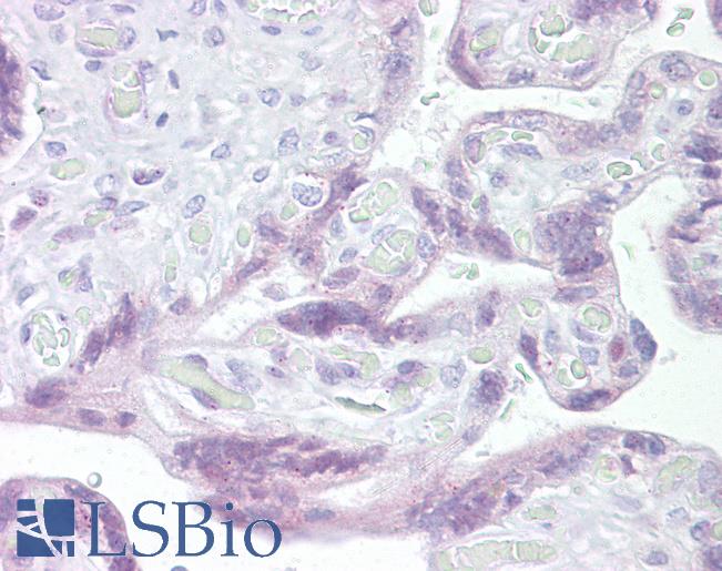 UTF1 Antibody - Human Placenta: Formalin-Fixed, Paraffin-Embedded (FFPE).  This image was taken for the unconjugated form of this product. Other forms have not been tested.